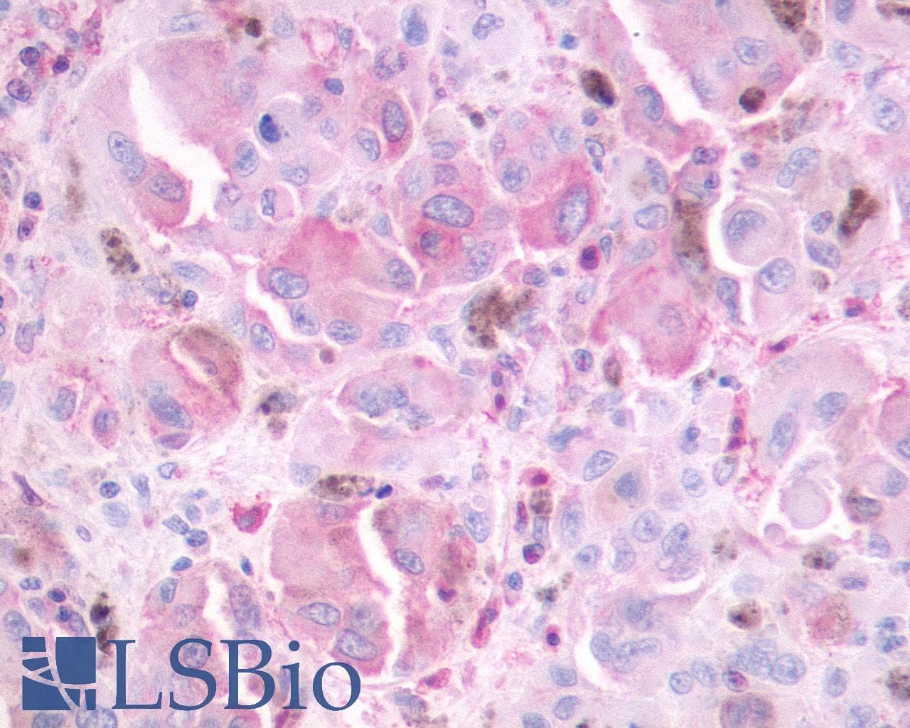 PathPlus™ MTNR1B / MT2 Antibody (Cytoplasmic Domain)