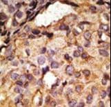 TLR6 Antibody (aa722-753)