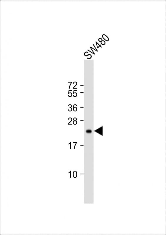TIMP2 Antibody (clone 1554CT494.262.47)