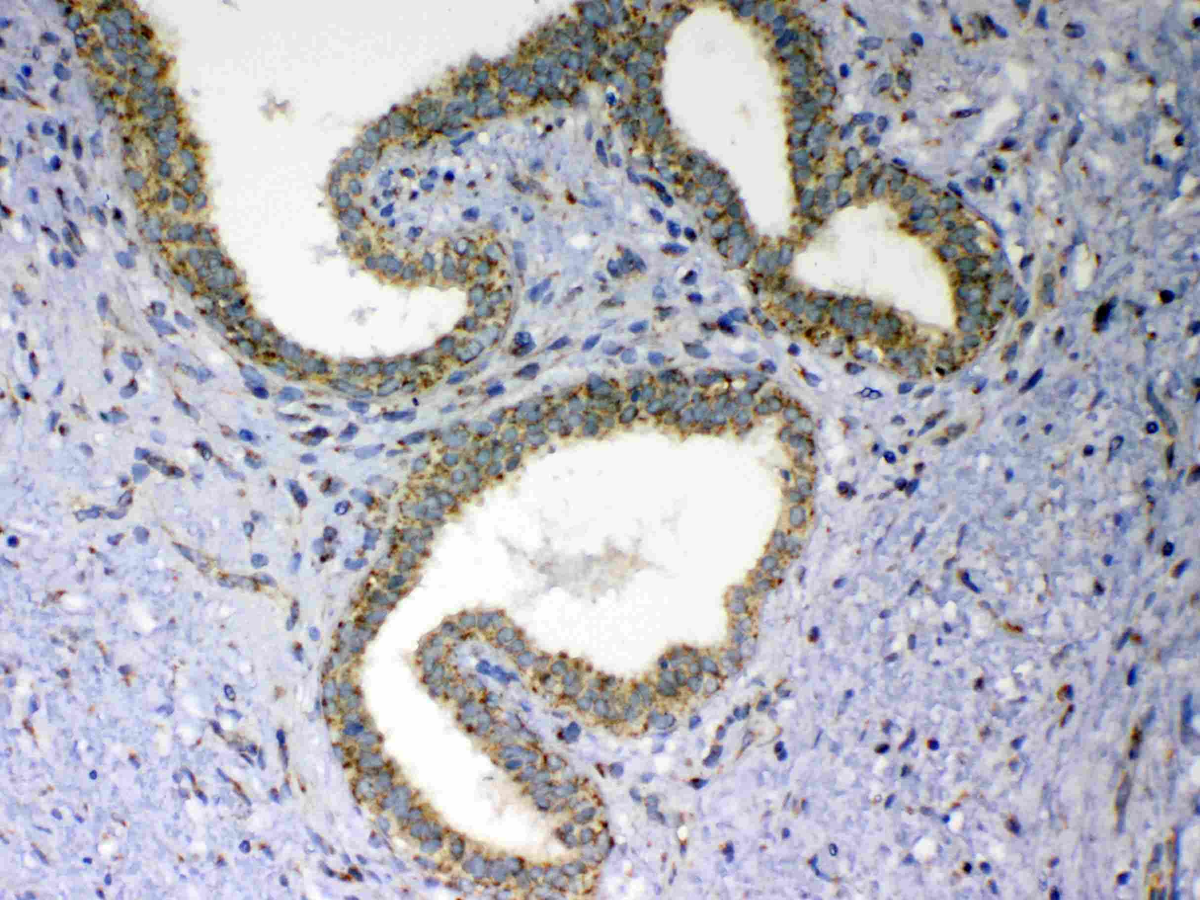 VISA / MAVS Antibody