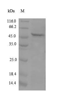Human APOM / Apolipoprotein M (Recombinant 10His-GST, N-terminus)