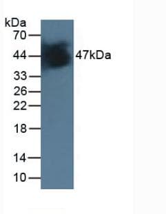IDH1 / IDH Antibody
