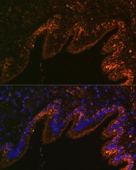 SCNN1A / ENaC Alpha Antibody