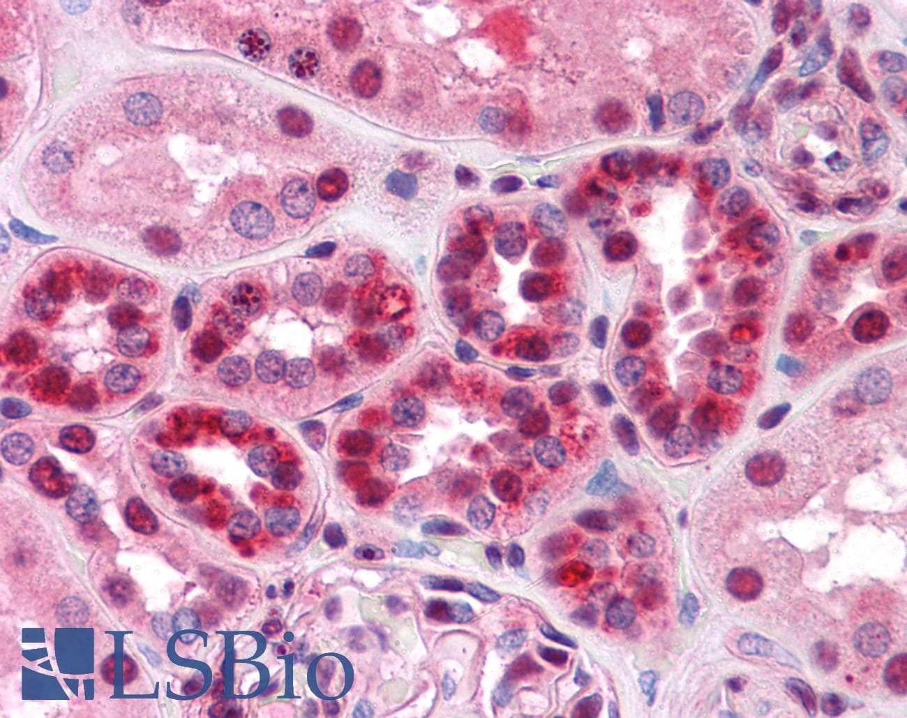 IHC-plus™ TDP-43 / TARDBP Antibody (clone 2E2-D3)
