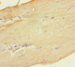 Polyclonal Rabbit anti-Human DGUOK / Deoxyguanosine Kinase Antibody (aa40-277)