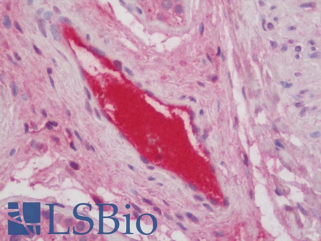 IHC-plus™ Complement C3 Antibody (aa1580-1592)