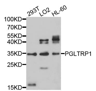 Polyclonal Rabbit anti-Human PGLYRP1 / PGRP Antibody (WB)