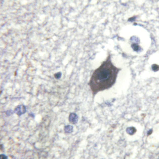 LIMK2 Antibody (phospho-Ser283)
