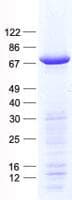 Human PFKFB1 Protein (Recombinant His, N-Terminal)