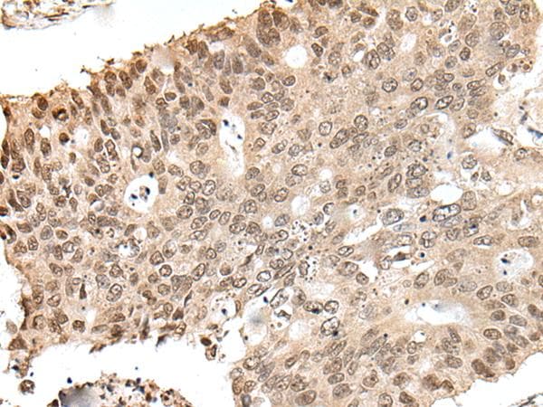 ZNF410 Antibody