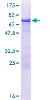 Human ZNHIT2 Protein (Recombinant GST)