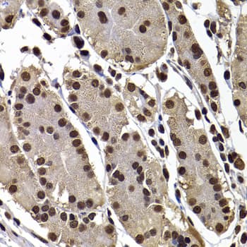 Polyclonal Rabbit anti-Human GPS1 / CSN1 Antibody (IHC, IF, WB)