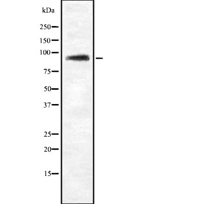 ZHX2 / RAF Antibody