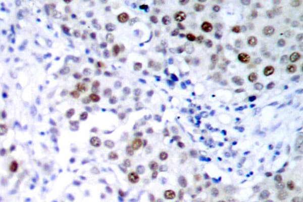 Polyclonal Rabbit anti-Human TP53 / p53 Antibody (phospho-Ser6, IHC, WB)