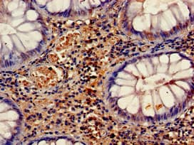 Polyclonal Rabbit anti-Human HELLS Antibody (IHC)