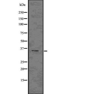 NCR1 / NKP46 Antibody
