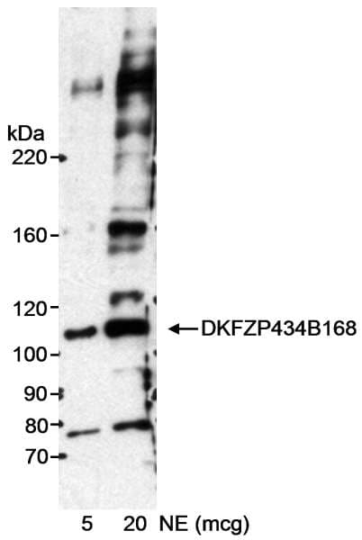 INT7 / INTS7 Antibody (aa850-900)