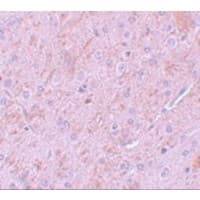 Polyclonal Rabbit anti-Human PIAS2 / PIASX Antibody (IHC, IF, WB)