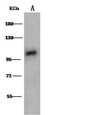VCAM1 / CD106 Antibody (Preservative Free)