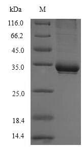 Human CD1C Protein (Recombinant 6His, N-terminus)