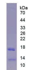 Human LIPC / Hepatic Lipase Protein (Recombinant His)