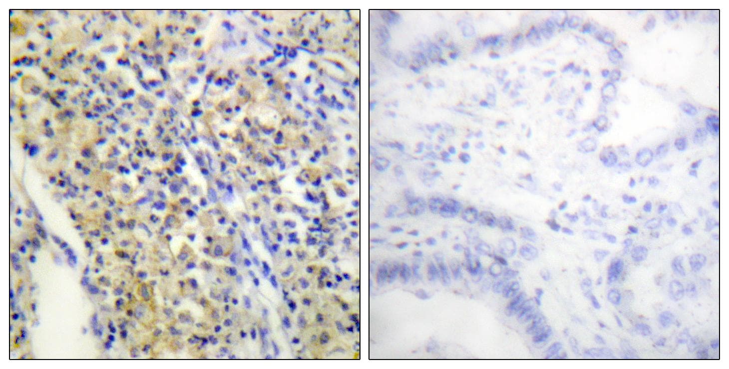 Polyclonal Rabbit anti-Human TPH1 / Tryptophan Hydroxylase Antibody (p260, IHC, IF, WB)