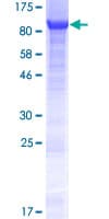 Human ANKRD13A Protein (Recombinant GST)