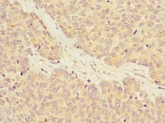RASA4 / CAPRI Antibody