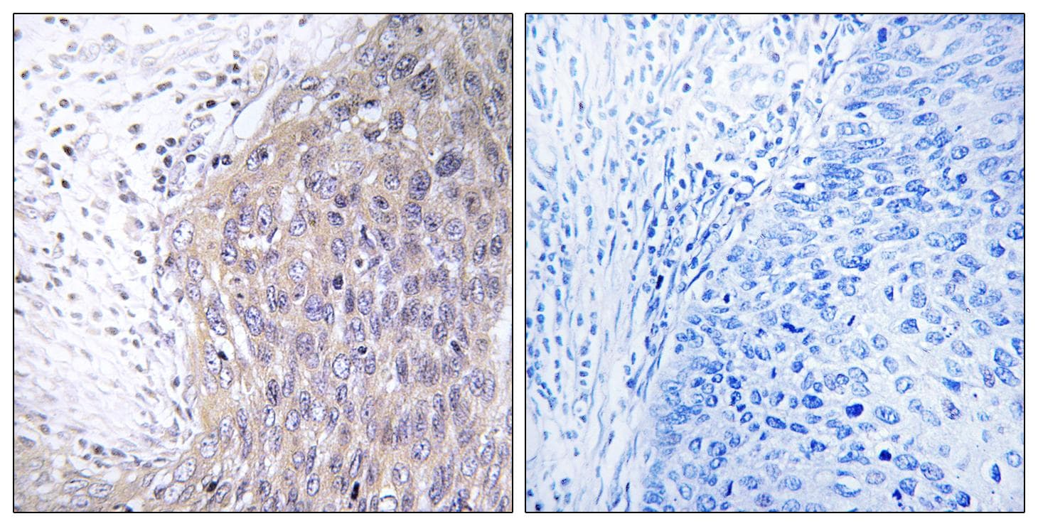 POLG2 Antibody