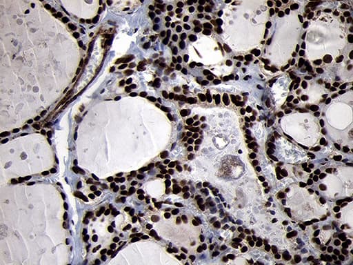 SMC1A / SMC1 Antibody (aa889-1016, clone OTI11E1)
