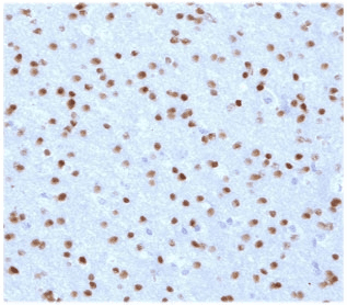 OLIG2 Antibody (clone ODTF2-1)