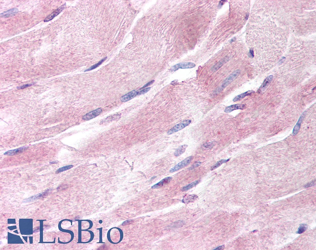 IHC-plus™ ADIPOR1/Adiponectin Receptor 1 Antibody