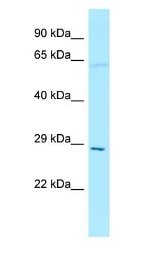 Polyclonal Rabbit anti-Human THTPA Antibody (N-Terminus, WB)
