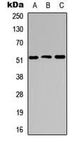 Polyclonal Rabbit anti-Human CTSC / Cathepsin C / JP Antibody (C-Terminus, WB)
