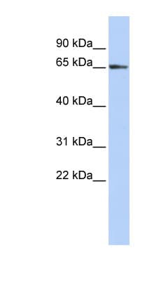 Polyclonal Rabbit anti-Human ZFP3 Antibody (aa108-157, WB)