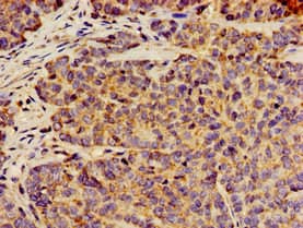 ANO1 / DOG1 / TMEM16A Antibody