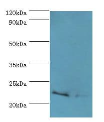 Polyclonal Rabbit anti-Human ASF1A Antibody (aa1-204, IHC, WB)
