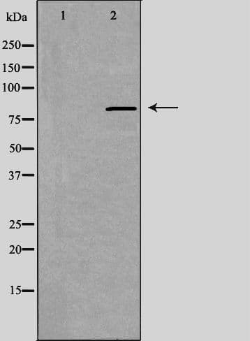 ANKK1 Antibody