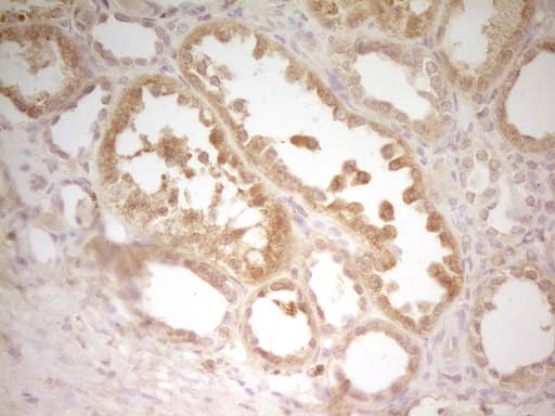 TRB3 / TRIB3 Antibody (aa1-200, clone OTI3G4)