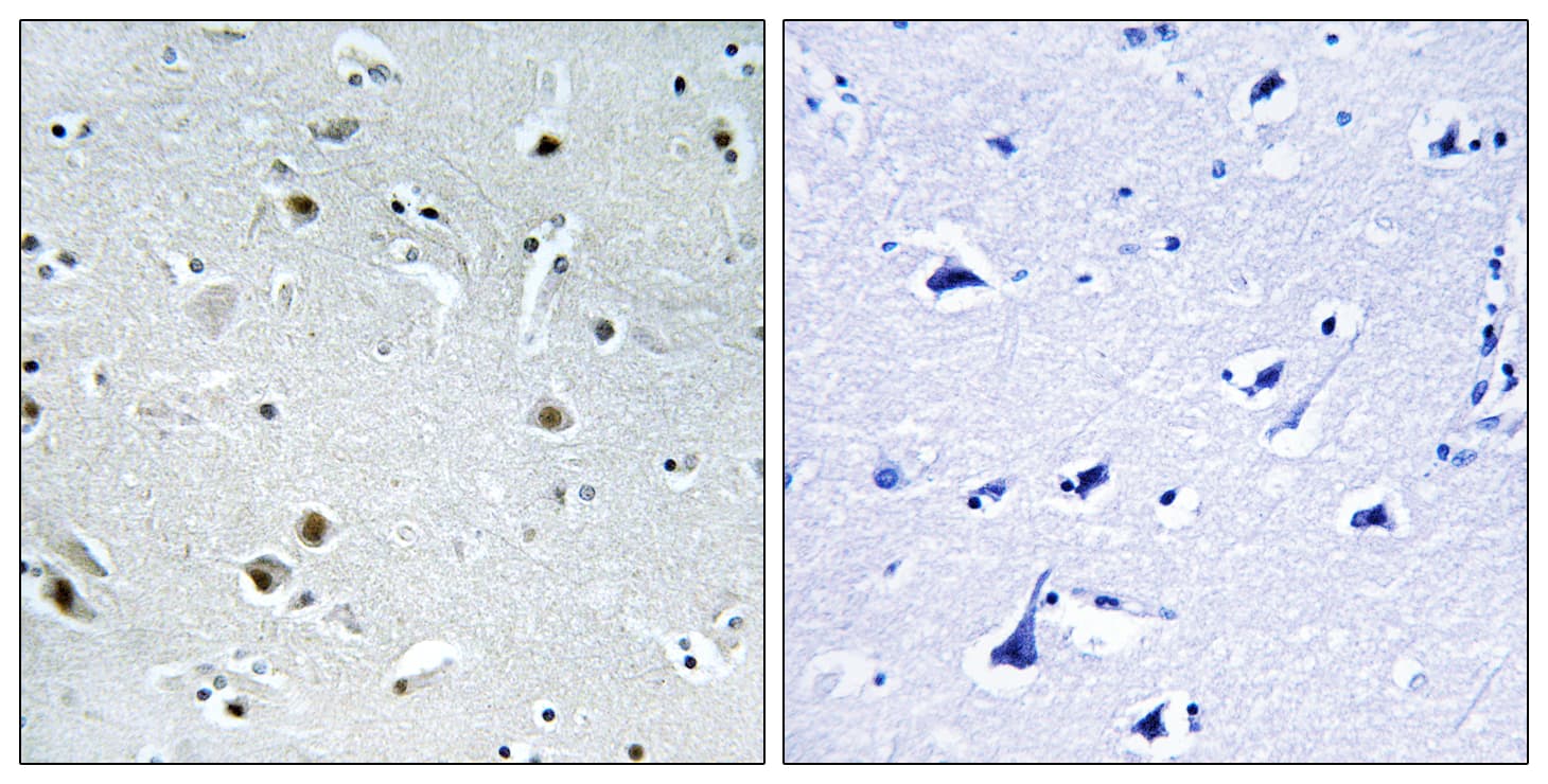 Polyclonal Rabbit anti-Human DDX24 Antibody (aa41-90, IHC)