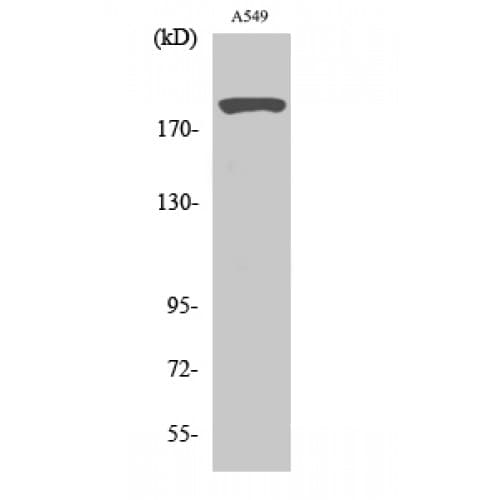 TP53BP1 / 53BP1 Antibody (1-80 aa)