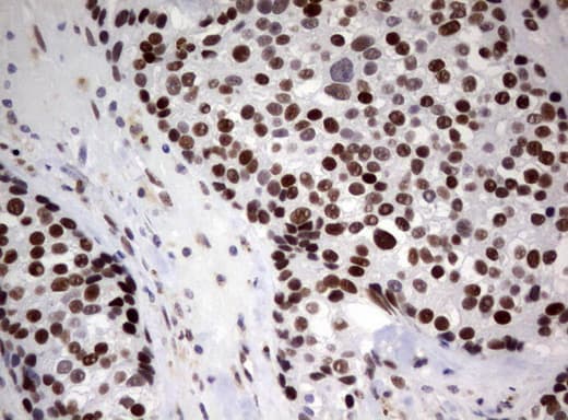 ZSCAN18 / ZNF447 Antibody (clone UMAB113, Carrier-free)