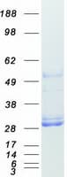 Human MSRA Protein (Recombinant Myc-DDK (Flag))