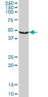 UPB1 Antibody (clone 3F12)