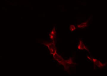 Polyclonal Rabbit anti-Human OAT Antibody (IF, WB)