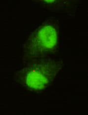 IHC-plus™ KDM5C / Jarid1C / SMCX Antibody (C-Terminus)