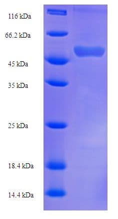 Human FDXR Protein (Recombinant His-SUMO)