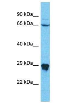 N4BP2L1 Antibody (aa163-212)