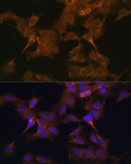 Polyclonal Rabbit anti-Human EIF2B2 Antibody (IHC, IF)