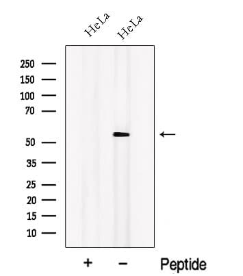 OSBPL2 Antibody
